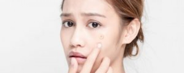 消除暗瘡印方法