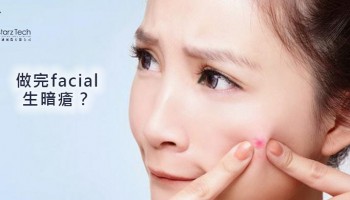 做完facial生暗瘡是什麼原因？